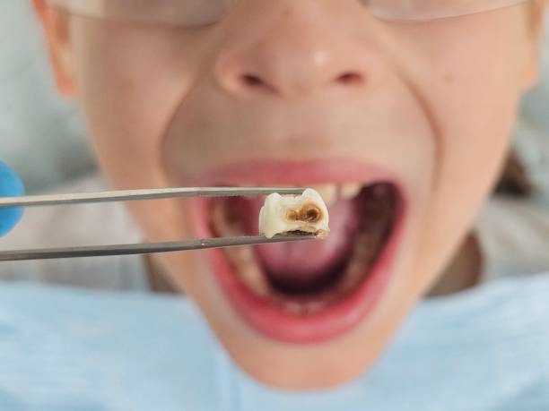 Best Weekend Emergency Dental Services in Fullerton, NE
