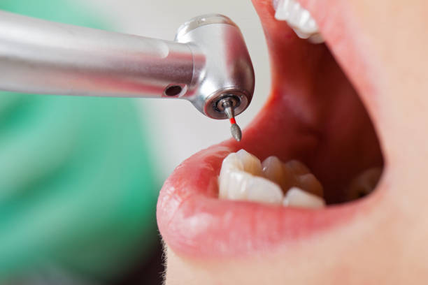 Best Emergency Treatment for Oral Infections in Fullerton, NE